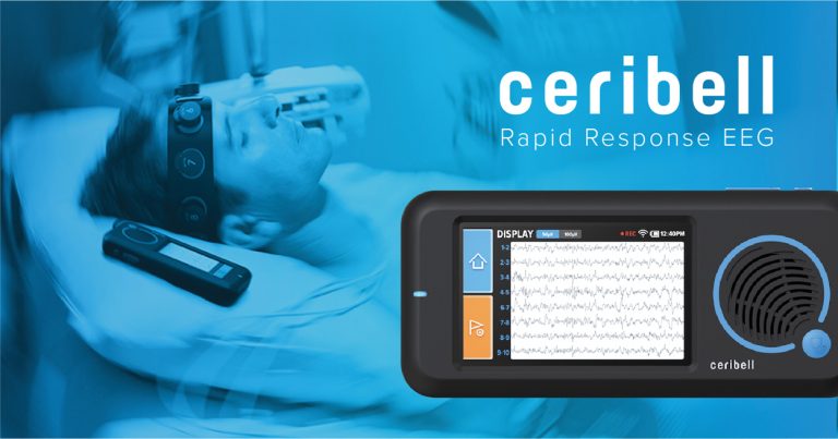 SMC FIRST IN STATE TO LAUNCH CERIBELL RAPID EEG BRAIN MONITORING ...